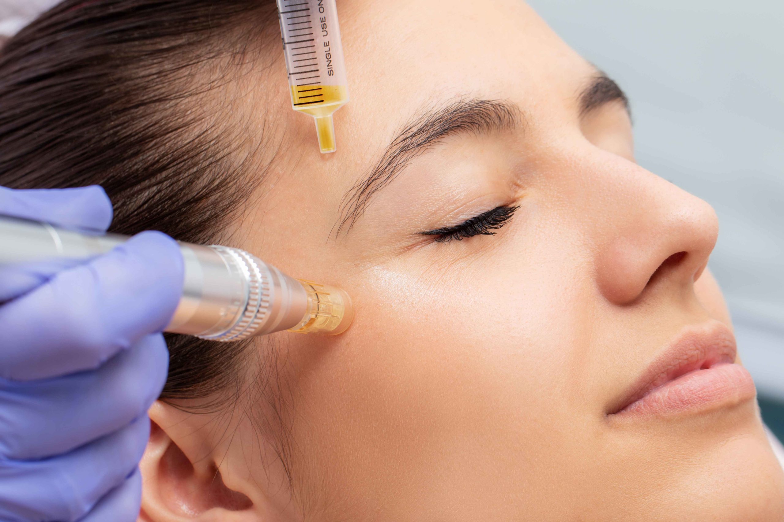 Natural Growth Factor Injections Facials | Skin care | Lady | Skintuition Medical Aesthetics