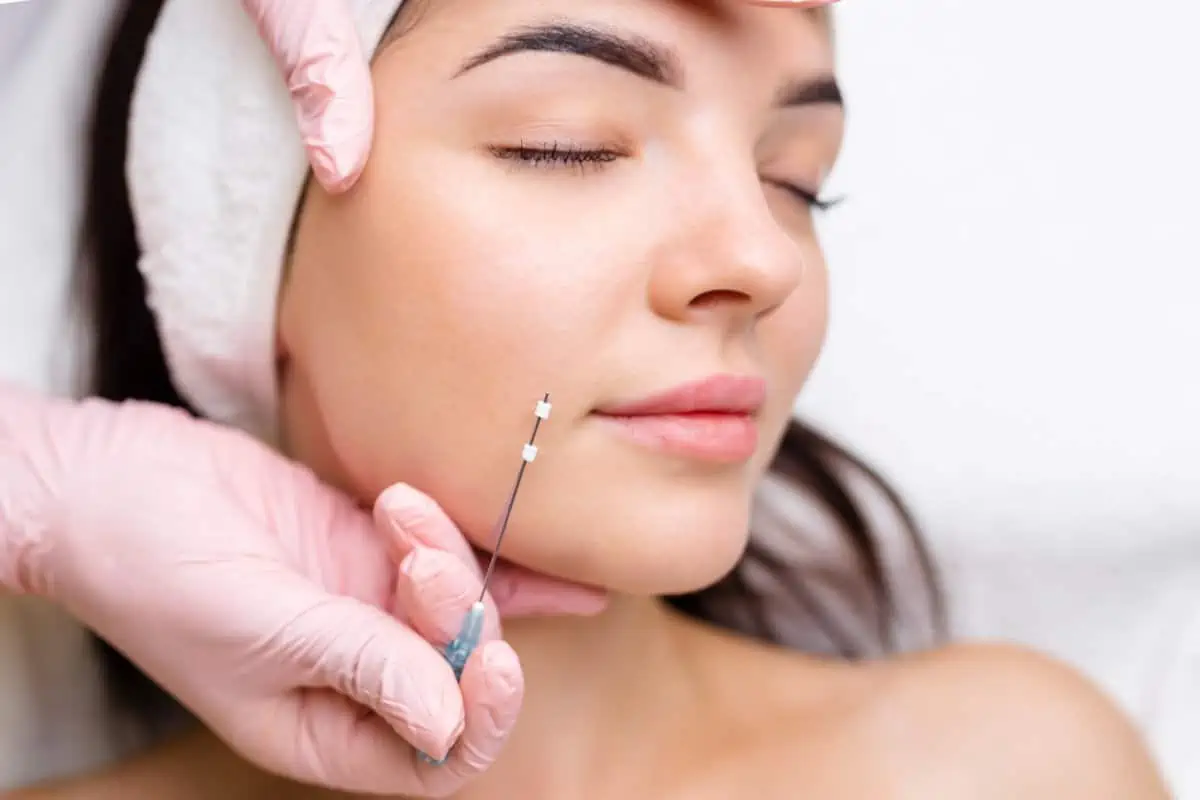 PDO thread therapy by Skintuition Medical Aesthetics in Hurley Dr. STE D Pocatello ID USA