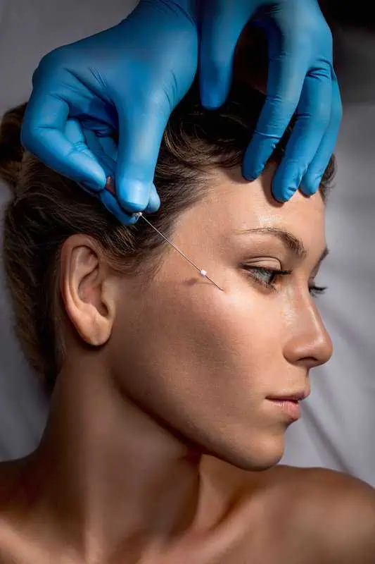 PDO Threads Treatment by Skintuition Medical Aesthetics in In Pocatello ID